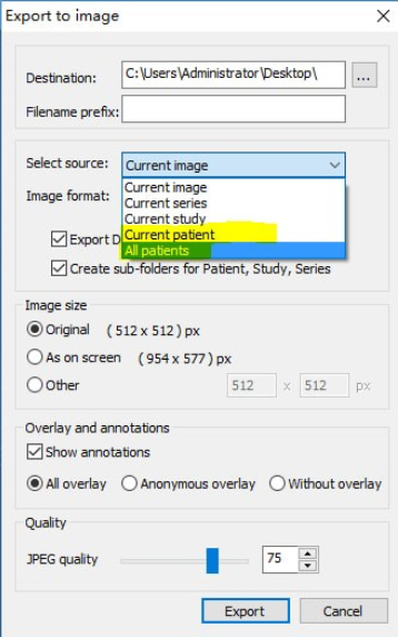 MicroDicom viewer