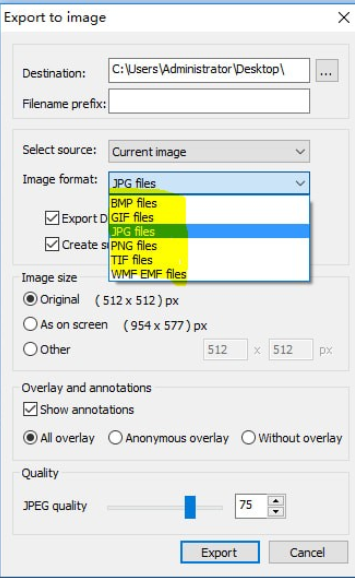 MicroDicom viewer