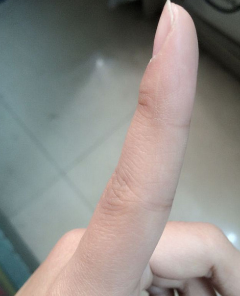 抖音食指上的疤痕代表什么 抖音秀男生女生食指疤痕什么梗